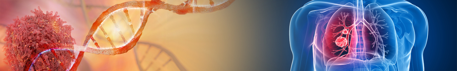 lung cancer in chennai