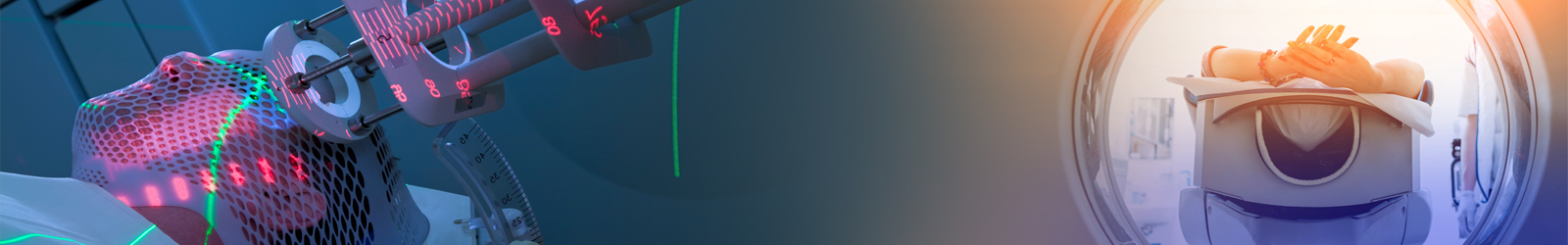 radiation therapy in chennai