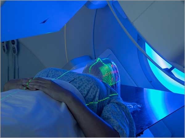 radiation oncology in chennai