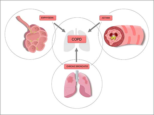 asthma symptoms in chennai