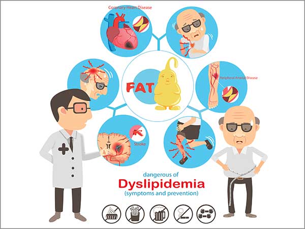 dyslipidemia in chennai